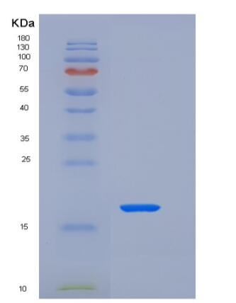 Recombinant Rat FAS / CD95 / APO-1 / TNFRSF6 Protein (His tag),Recombinant Rat FAS / CD95 / APO-1 / TNFRSF6 Protein (His tag)