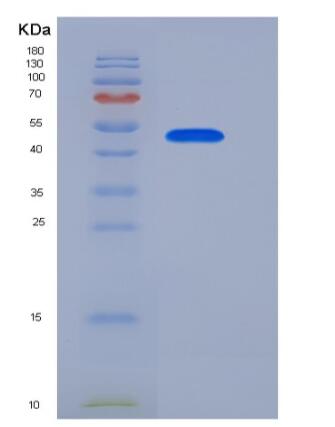 Recombinant Human NTPDase 2 / ENTPD2 Protein (aa 29-460, His tag),Recombinant Human NTPDase 2 / ENTPD2 Protein (aa 29-460, His tag)