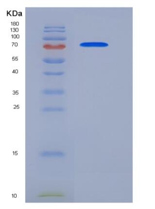 Recombinant Human ECE1 Protein (His tag),Recombinant Human ECE1 Protein (His tag)