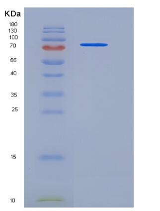 Recombinant Human PROS1 / Protein S Protein (His tag),Recombinant Human PROS1 / Protein S Protein (His tag)