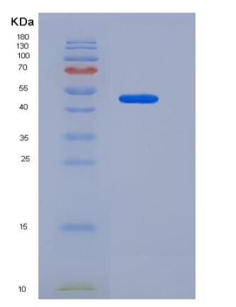 Recombinant Human CD31 / PECAM1 Protein (His tag),Recombinant Human CD31 / PECAM1 Protein (His tag)