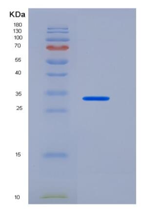 Recombinant Human CEACAM8 / CD66b Protein (His tag),Recombinant Human CEACAM8 / CD66b Protein (His tag)