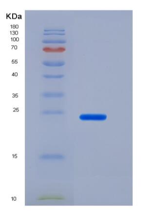 Recombinant Human CD200 / OX-2 Protein (His tag),Recombinant Human CD200 / OX-2 Protein (His tag)