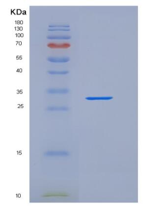 Recombinant Human TIM4 / TIMD4 Protein (His tag),Recombinant Human TIM4 / TIMD4 Protein (His tag)