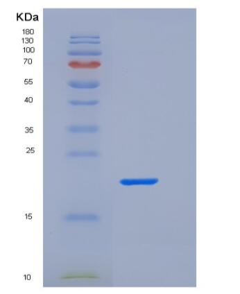 Recombinant Human Fc γ RIIa/FCGR2A/CD32a Protein(C-6His),Recombinant Human Fc γ RIIa/FCGR2A/CD32a Protein(C-6His)