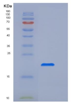 Recombinant Human Fc γ RIIa/FCGR2A/CD32a Protein(C-6His,H131),Recombinant Human Fc γ RIIa/FCGR2A/CD32a Protein(C-6His,H131)