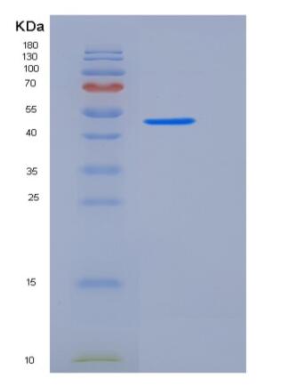 Recombinant Human CD200 / OX-2 Protein (His & Fc tag),Recombinant Human CD200 / OX-2 Protein (His & Fc tag)