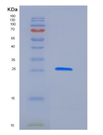 Recombinant Human Latexin / LXN / TCI Protein (His tag),Recombinant Human Latexin / LXN / TCI Protein (His tag)