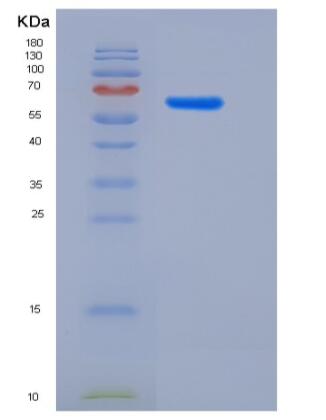 Recombinant Rat Galectin-8 / LGALS8 Protein (GST tag),Recombinant Rat Galectin-8 / LGALS8 Protein (GST tag)
