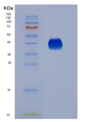 Eukaryotic Fc Fragment Of IgG Low Affinity IIIa Receptor (FcgR3A),Eukaryotic Fc Fragment Of IgG Low Affinity IIIa Receptor (FcgR3A)