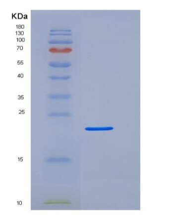Recombinant Human Fc γ RIIIA/FCGR3A/CD16a Protein(C-6His,Val176Phe),Recombinant Human Fc γ RIIIA/FCGR3A/CD16a Protein(C-6His,Val176Phe)