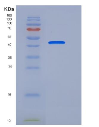 Recombinant Human ENPP7 / NPP-7 Protein (His tag),Recombinant Human ENPP7 / NPP-7 Protein (His tag)