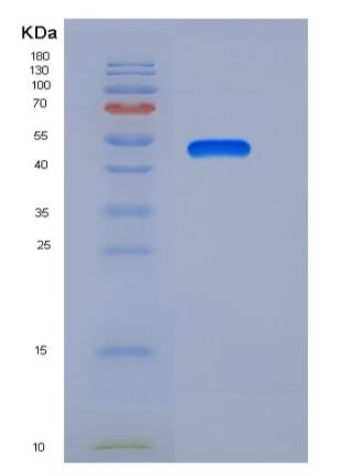 Recombinant Human Latexin / LXN / TCI Protein (Fc tag),Recombinant Human Latexin / LXN / TCI Protein (Fc tag)