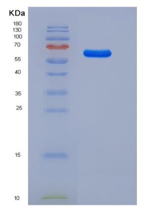 Recombinant Rat LAMP1 / CD107a Protein (Fc tag),Recombinant Rat LAMP1 / CD107a Protein (Fc tag)