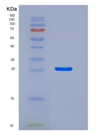 Recombinant Human Kallikrein 6 Protein (His Tag),Recombinant Human Kallikrein 6 Protein (His Tag)