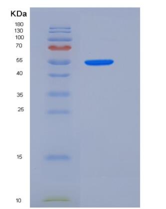 Recombinant Rat GPT1 / GPT Protein (His tag),Recombinant Rat GPT1 / GPT Protein (His tag)