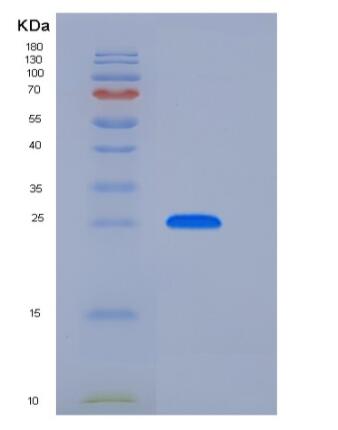 Recombinant Human GLIPR1 Protein (His Tag),Recombinant Human GLIPR1 Protein (His Tag)