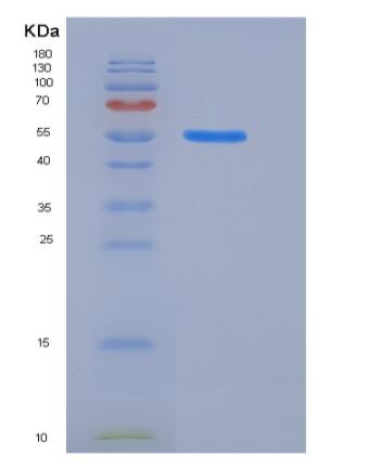 Recombinant Rat KIRREL3 / NEPH2 Protein (His tag),Recombinant Rat KIRREL3 / NEPH2 Protein (His tag)