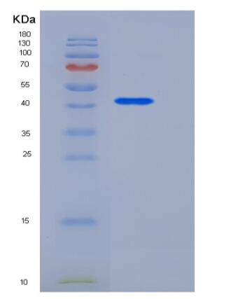 Recombinant Human DDR2 Kinase / CD167b Protein (Fc tag),Recombinant Human DDR2 Kinase / CD167b Protein (Fc tag)