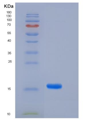 Recombinant Human FABP4 / ALBP / A-FABP Protein (29 Ala/Thr, His tag),Recombinant Human FABP4 / ALBP / A-FABP Protein (29 Ala/Thr, His tag)