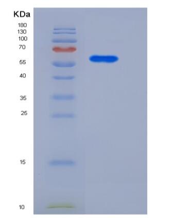 Recombinant Human CD146 / MCAM Protein (His tag),Recombinant Human CD146 / MCAM Protein (His tag)