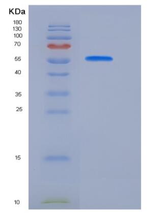 Recombinant Rat BCAM Protein (His tag),Recombinant Rat BCAM Protein (His tag)