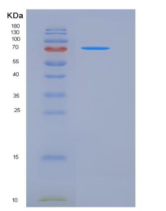 Recombinant Mouse E-Cadherin / CDH1 / E-cad / CD324 Protein (His tag),Recombinant Mouse E-Cadherin / CDH1 / E-cad / CD324 Protein (His tag)