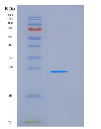 Recombinant Human FcERI / FCER1A Protein (His tag),Recombinant Human FcERI / FCER1A Protein (His tag)