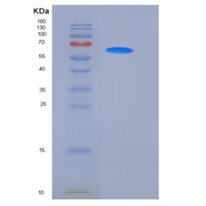Recombinant Mouse CD14 Protein (His & Fc tag)