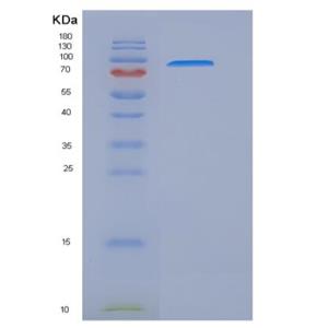 Recombinant Rat HER2 / ErbB2 Protein (Fc tag)