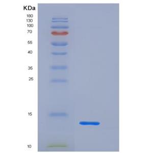 Recombinant Mouse CD83 Protein (His Tag),Recombinant Mouse CD83 Protein (His Tag)