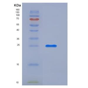 Recombinant Mouse CXADR Protein (His tag)