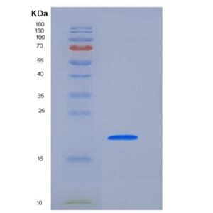 Recombinant Human PTH1R Protein (His Tag)