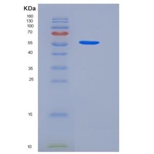 Recombinant Human tPA / PLAT Protein (Fc tag),Recombinant Human tPA / PLAT Protein (Fc tag)