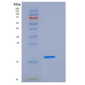 Recombinant Human Fas Protein (His Tag),Recombinant Human Fas Protein (His Tag)