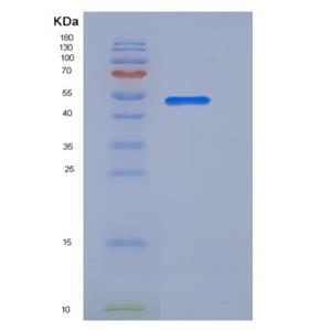 Recombinant Mouse B7-H4 / B7S1 / B7x Protein (Fc tag)
