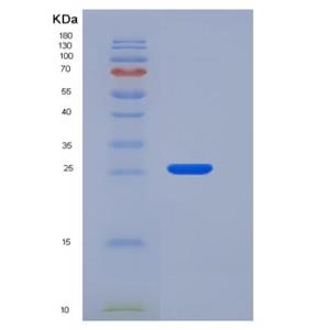 Recombinant Human CLM-9 / TREM4 / CD300LG Protein (His tag),Recombinant Human CLM-9 / TREM4 / CD300LG Protein (His tag)