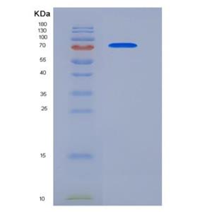 Recombinant Human ECE1 Protein (His tag),Recombinant Human ECE1 Protein (His tag)