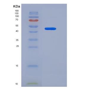 Recombinant Human CD31 / PECAM1 Protein (His tag),Recombinant Human CD31 / PECAM1 Protein (His tag)