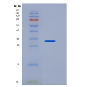 Recombinant Human CEACAM8 / CD66b Protein (His tag)