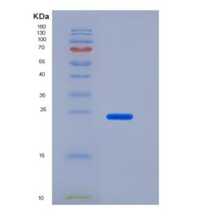 Recombinant Human CD200 / OX-2 Protein (His tag),Recombinant Human CD200 / OX-2 Protein (His tag)