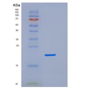 Recombinant Human Fc γ RIIa/FCGR2A/CD32a Protein(C-6His)