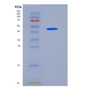 Recombinant Human ULBP2 / N2DL-2 Protein (Fc tag)