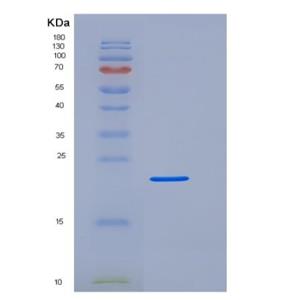 Recombinant Human Fc γ RIIIA/FCGR3A/CD16a Protein(C-6His,Val176Phe),Recombinant Human Fc γ RIIIA/FCGR3A/CD16a Protein(C-6His,Val176Phe)