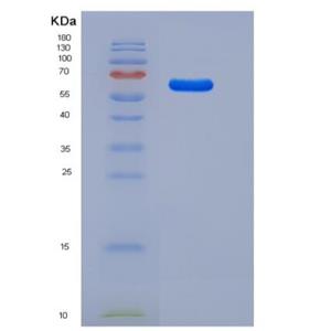 Recombinant Rat LAMP1 / CD107a Protein (Fc tag)