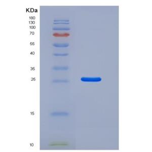 Recombinant Human Kallikrein 6 Protein (His Tag)
