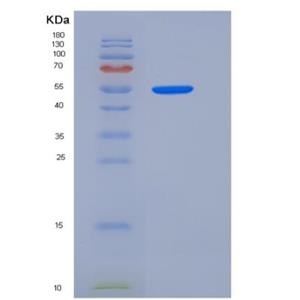 Recombinant Rat GPT1 / GPT Protein (His tag),Recombinant Rat GPT1 / GPT Protein (His tag)