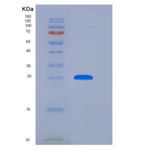 Recombinant Human GLIPR1 Protein (His Tag)
