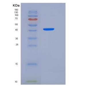 Recombinant Human DDR2 Kinase / CD167b Protein (His tag),Recombinant Human DDR2 Kinase / CD167b Protein (His tag)