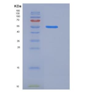 Recombinant Rat KIRREL3 / NEPH2 Protein (His tag),Recombinant Rat KIRREL3 / NEPH2 Protein (His tag)